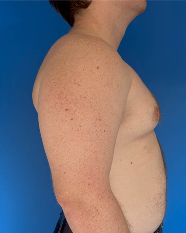 Procedure case #4031