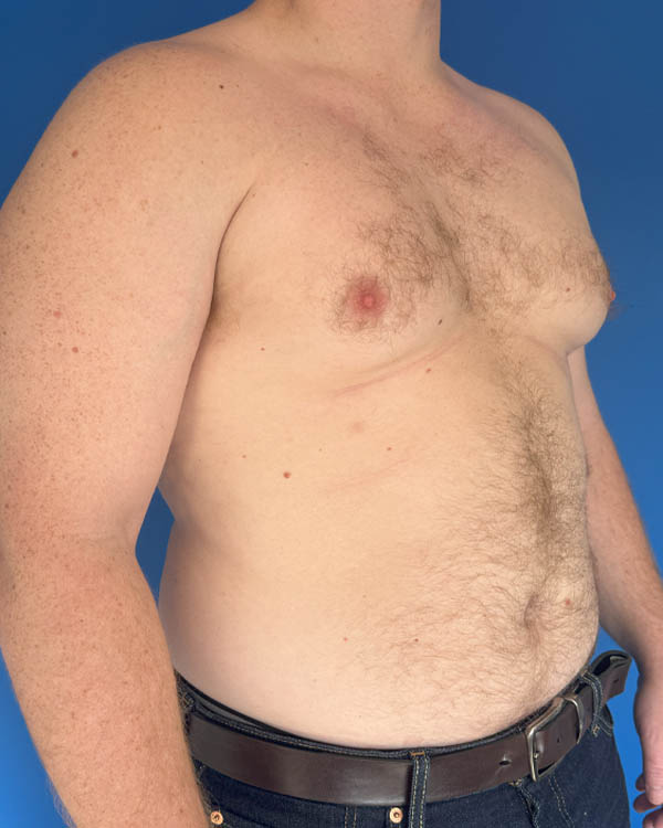 Procedure case #4031