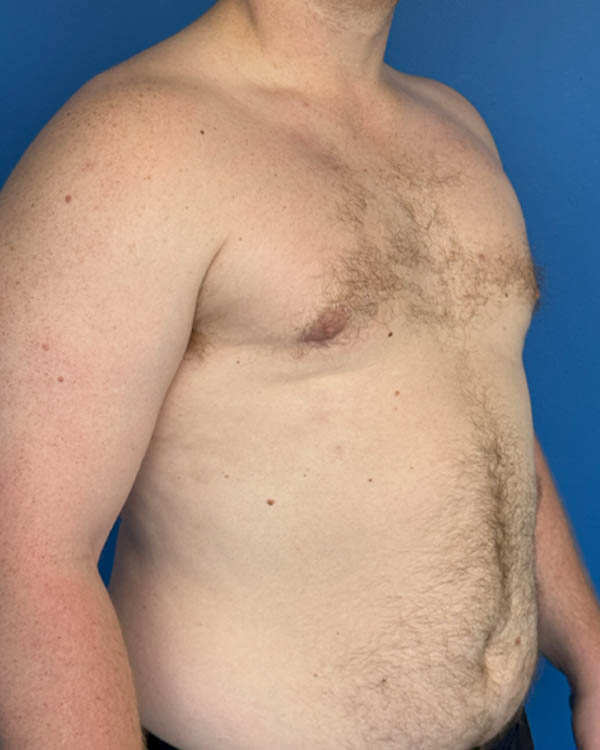 Procedure case #4031